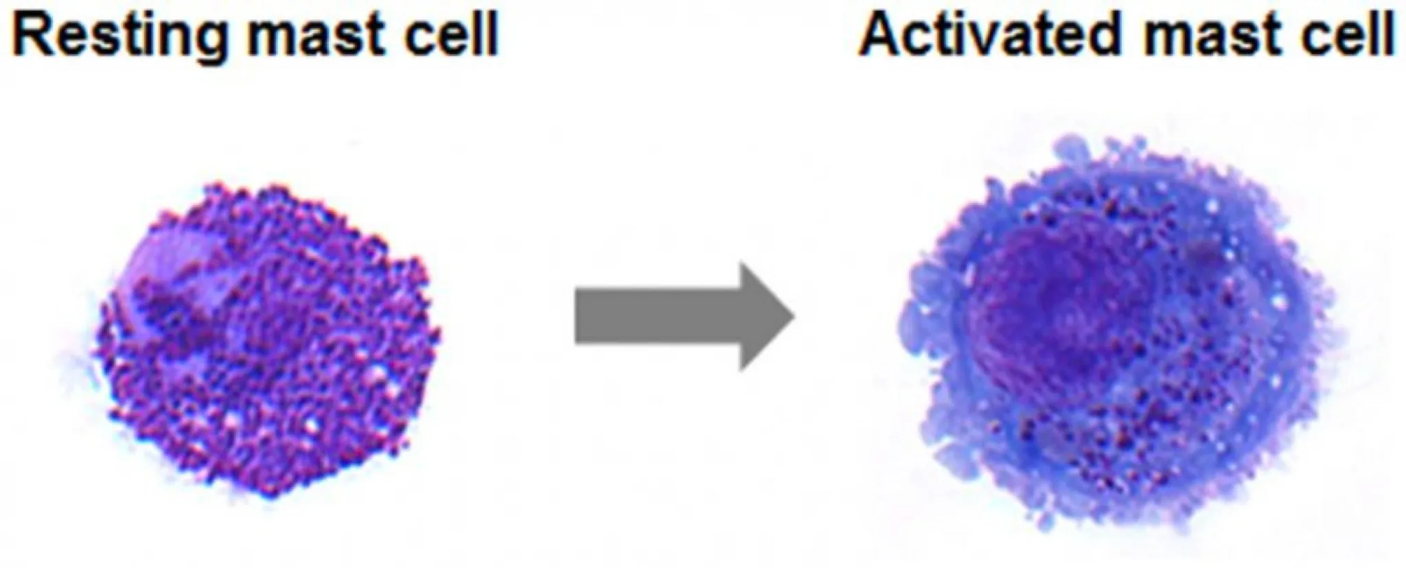Micrograph comparing a resting mast cell to an activated mast cell